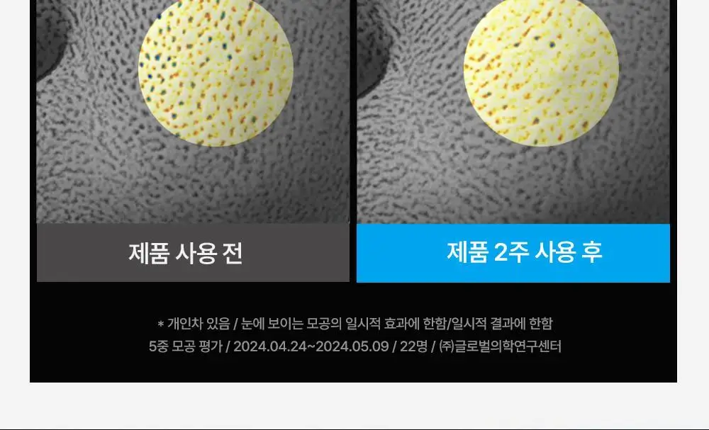[모공밴딩크림] 웰라쥬 하이퍼 펩타이드 밴디지 크림 50ml 상세페이지 17